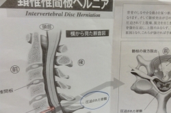 閉所恐怖症